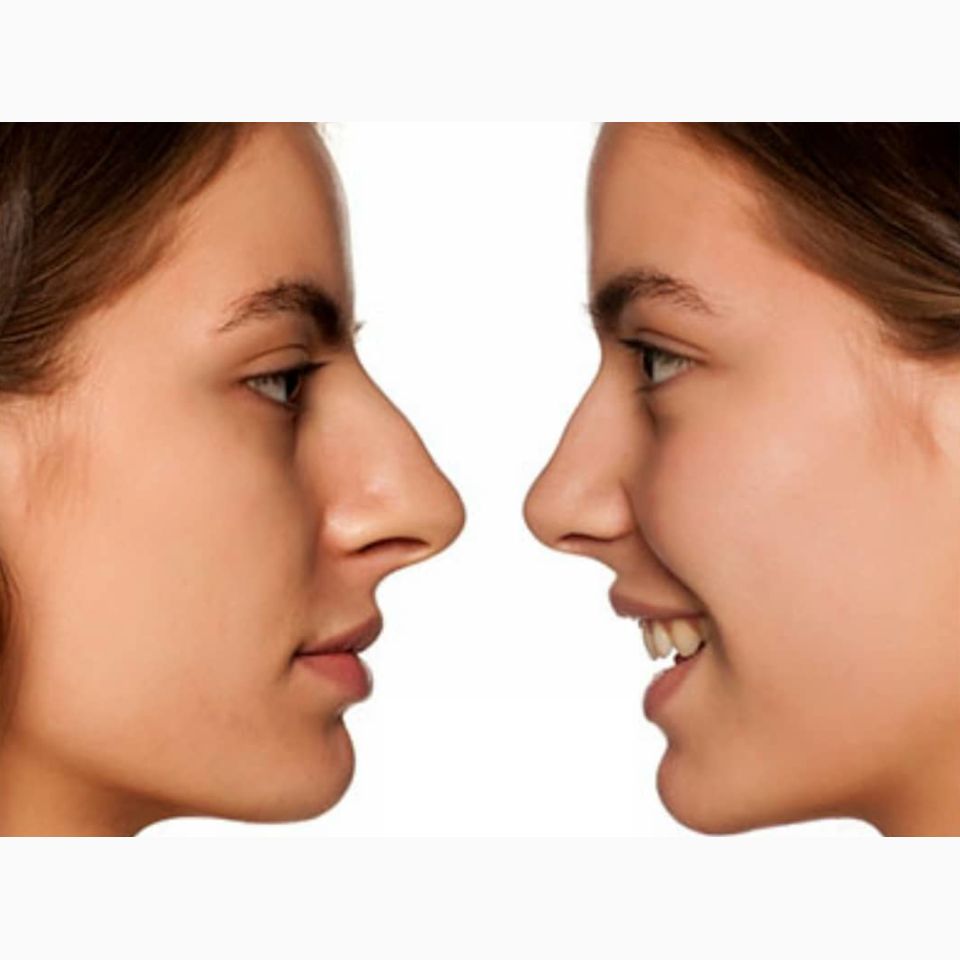 Dr. Jairo Zalamea Silva - Cirugía Plástica